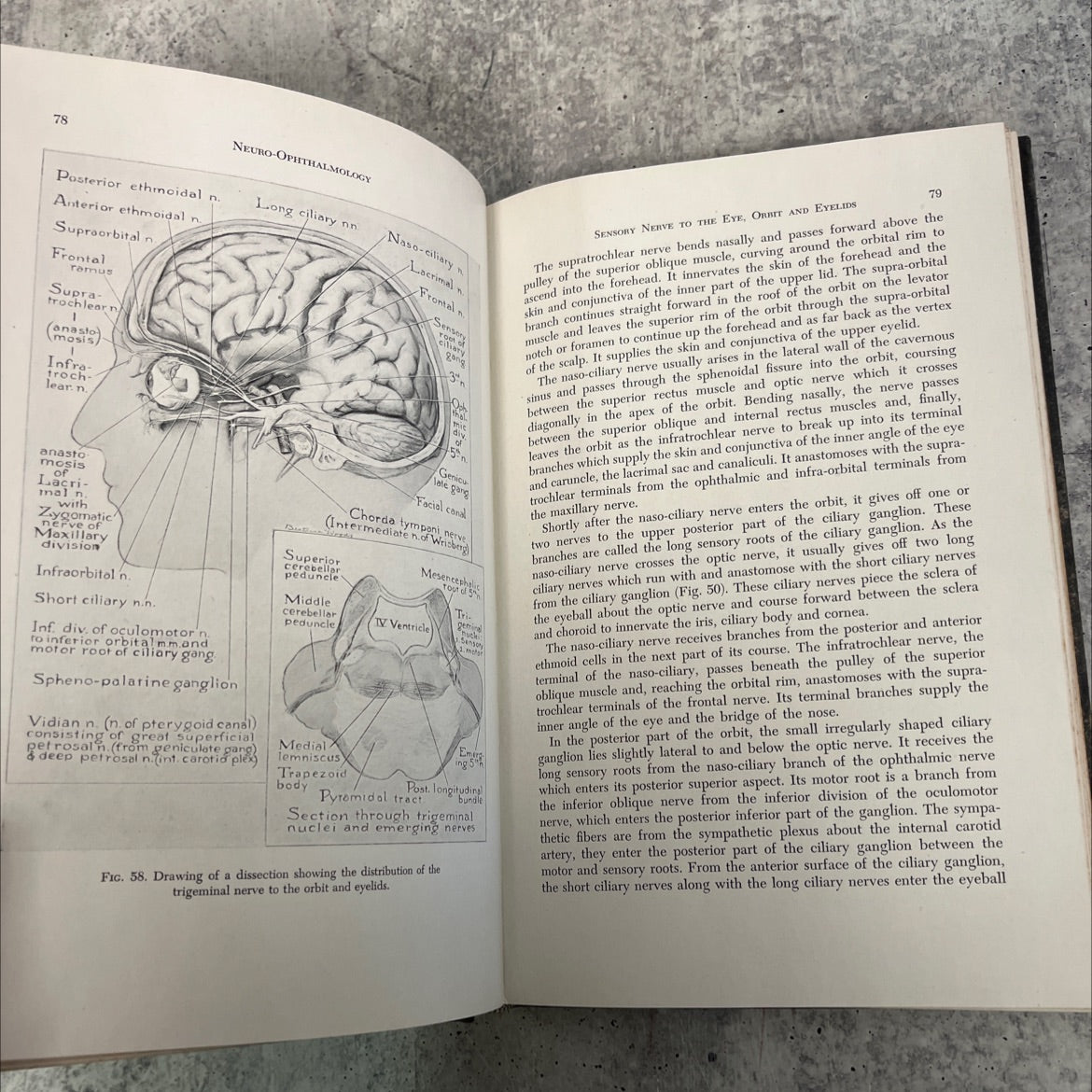 neuro-ophthalmology book, by donald j. lyle, 1945 Hardcover image 4